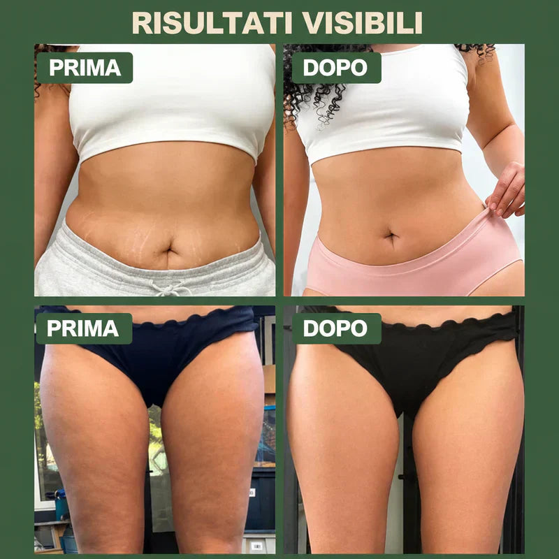 Massaggiatore Anticellulite Caldo